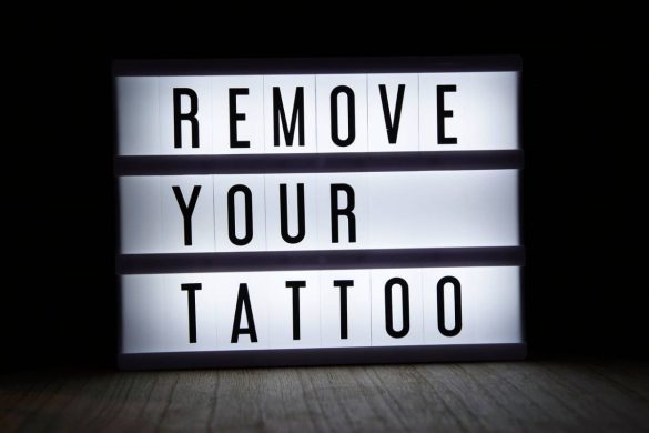 How To Understand and Budget for Tattoo Removal Cost